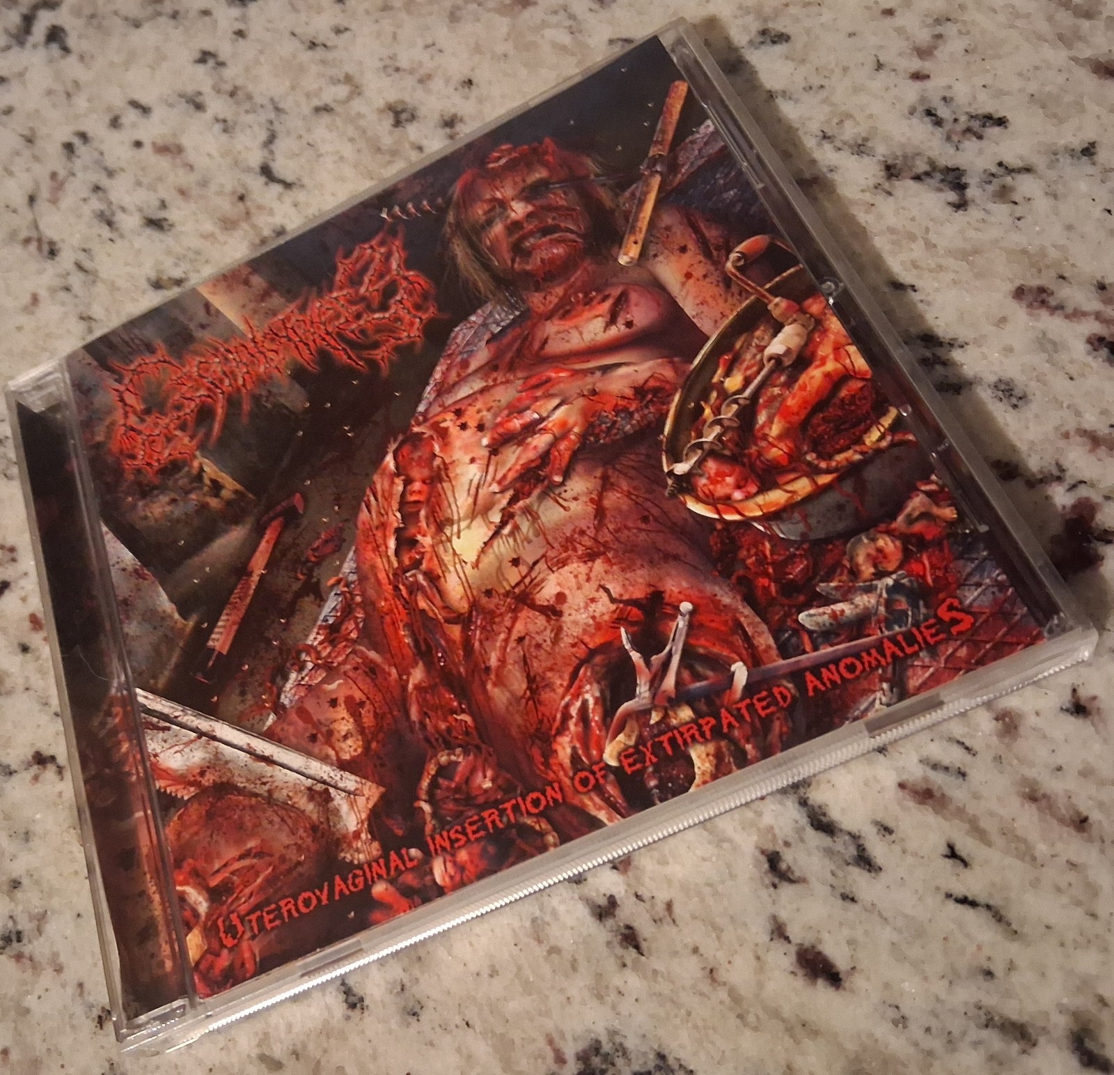 CEPHALOTRIPSY "Uterovaginal" CD LAST DAYS CLEAN FLESH DEVOURMENT KRAANIUM GUT